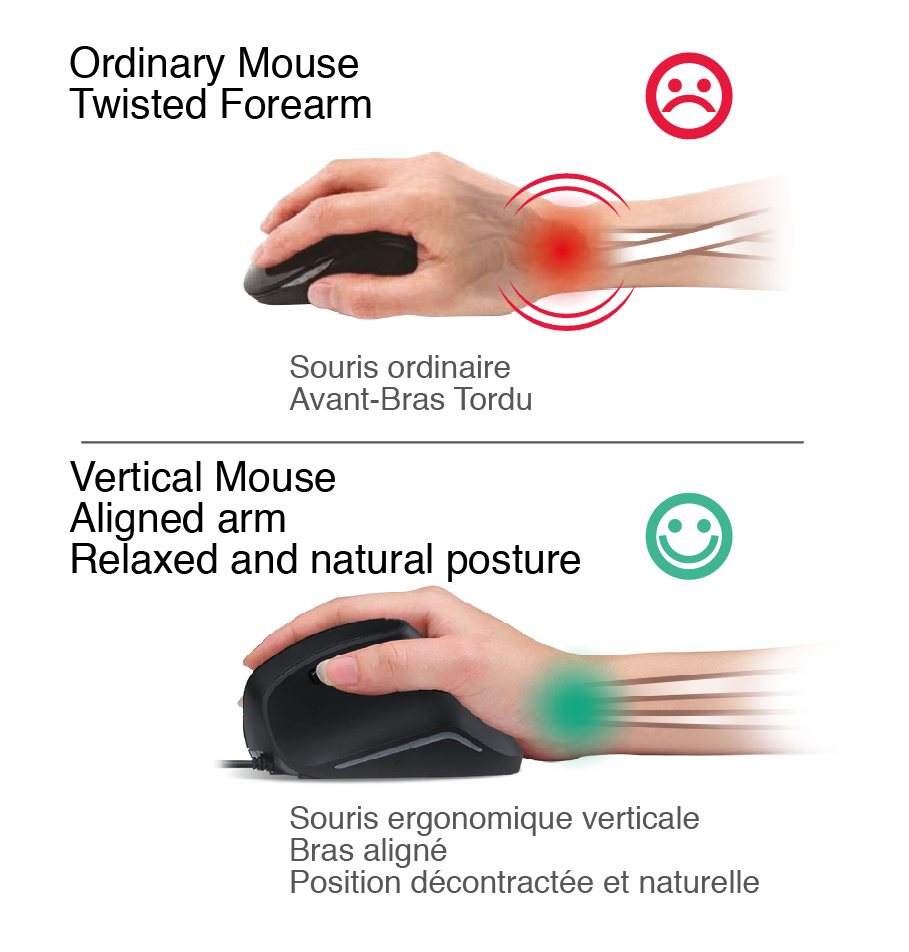 souris ergonomique